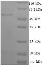 Glycerol-3-phosphate dehydrogenase [NAD (+)], Cytoplasmic domain (GPD1), human, recombinant