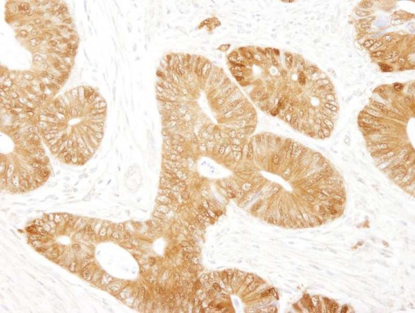 Anti-Beta-catenin (IHC)