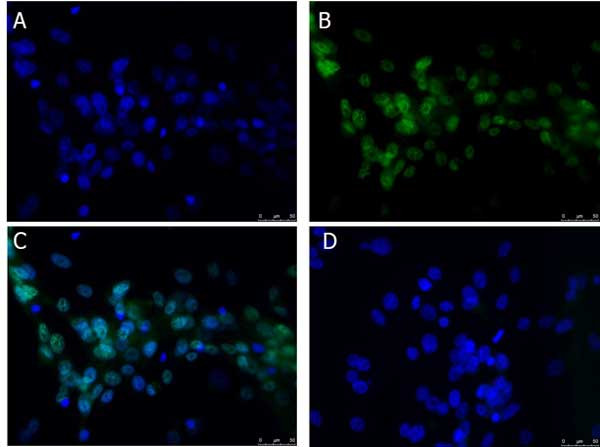 Anti-BCL3