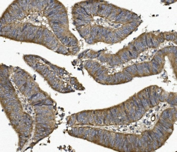 Anti-UNG / Uracil-DNA Glycosylase