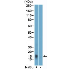 Anti-H2BK11ac / Acetyl-Histone H2B Lysine 11, clone RM456