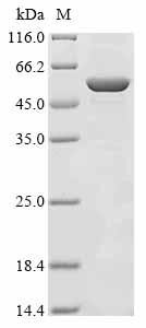 Cell division protein FtsZ (ftsZ), Porphyromonas gingivalis, recombinant