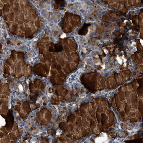 Anti-CNTN6