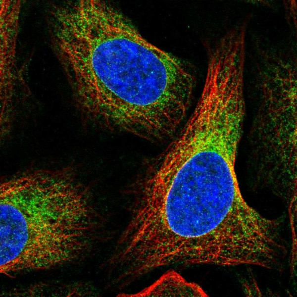 Anti-SPTLC1