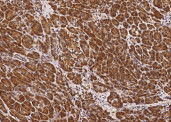 Anti-CLPS Monoclonal Antibody