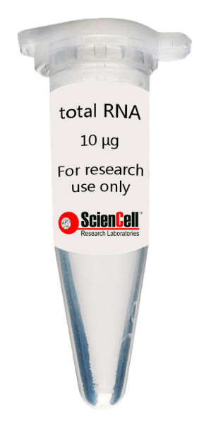 Human Oral Keratinocyte Total RNA