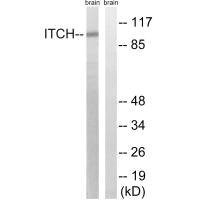 Anti-ITCH (Ab-420)