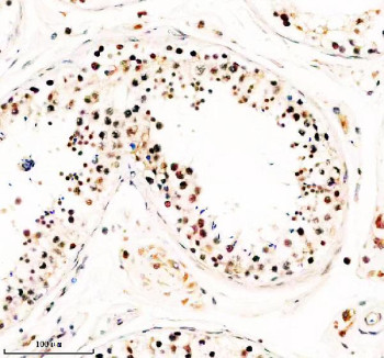 Anti-TAF5 / TATA-box binding protein-associated factor 5
