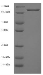 Ganglioside-induced differentiation-associated protein 2 (GDAP2), human, recombinant