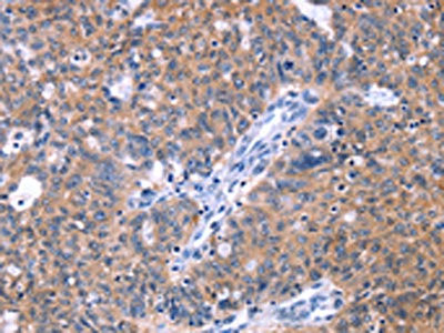Anti-ZNF395