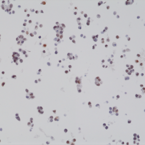 Anti-BAG-1L (human), Rabbit Monoclonal (RM310)
