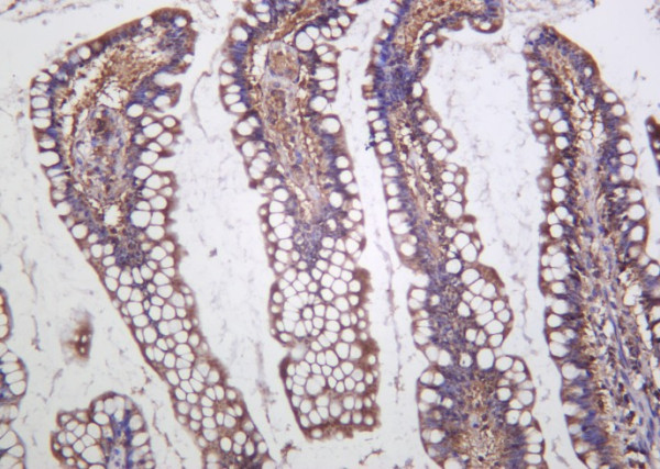 Anti-Recombinant Cystathionase, clone 2D13