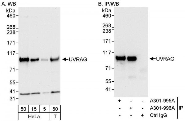 Anti-UVRAG