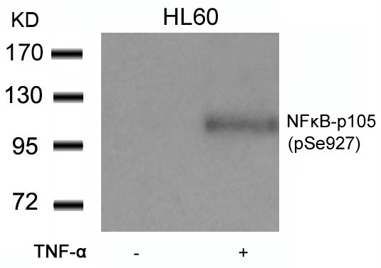 Anti-phospho-NFkB p105 (Ser927)