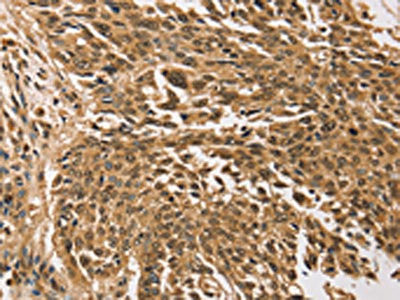 Anti-TGM7