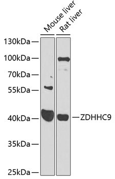 Anti-ZDHHC9
