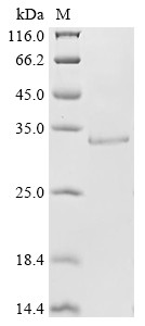A disintegrin and metalloproteinase with thrombospondin motifs 2 (ADAMTS2), partial, human, recombin