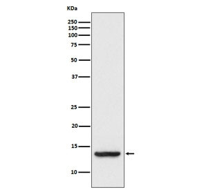 Anti-TAX1BP3 / TIP-1, clone ADDC-20