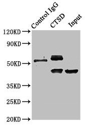 Anti-CTSD