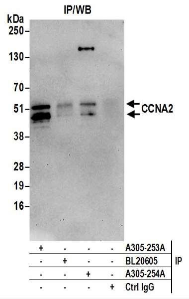Anti-CCNA2/Cyclin A2