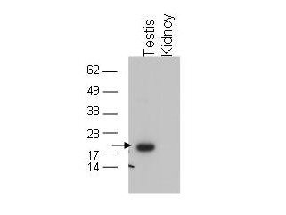 Anti-Glutathione Peroxidase 4 (Gpx4)