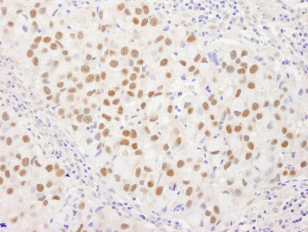 Anti-WRNIP1 (IHC)