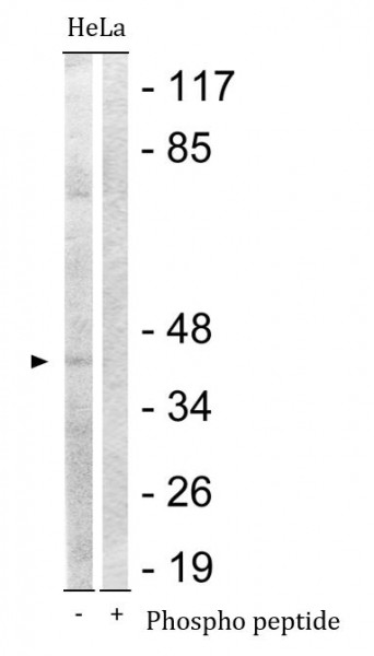 Anti-phospho-CDK7 (Thr170)