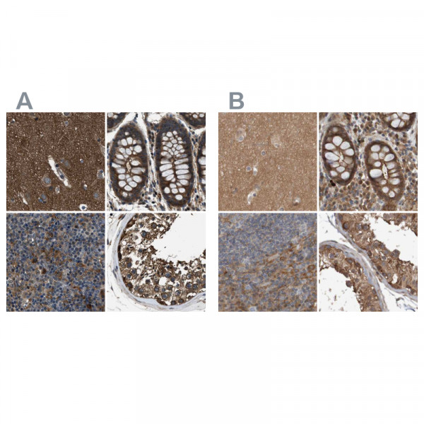 Anti-ARHGEF11