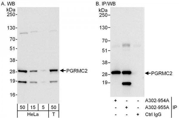 Anti-PGRMC2