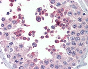 Anti-MLL4