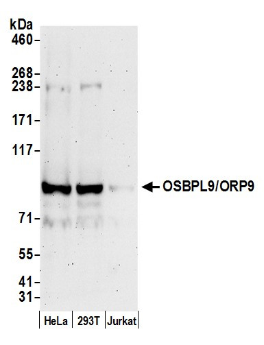 Anti-OSBPL9/ORP9