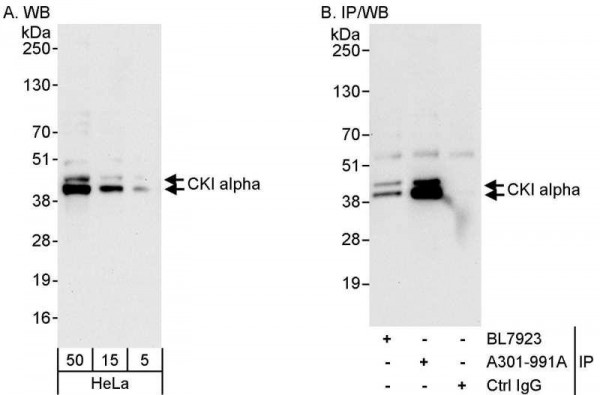 Anti-CKI alpha