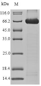 CD166 antigen (ALCAM), partial, human, recombinant