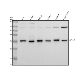 Anti-UCHL3 / Ubiquitin C-terminal hydrolase L3