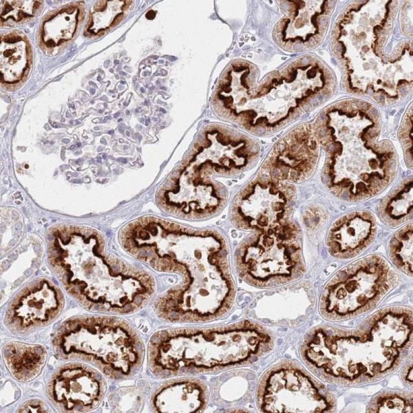 Anti-PKD2L2