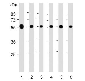 Anti-CALR / Calreticulin