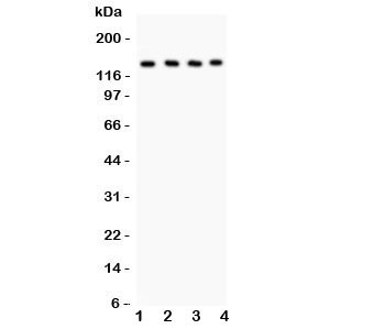Anti-PLCB1 / Phospholipase C-beta-1