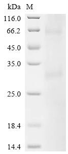 Melanocortin receptor 4 (MC4R), recombinant human