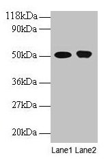 Anti-ODC1
