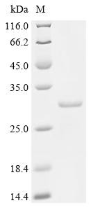 COMM domain-containing protein 9 (Commd9), mouse, recombinant