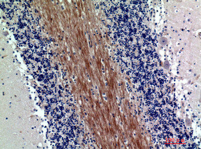 Anti-SIRPA/SIRPB1