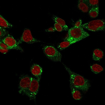 Anti-CSPG4 / NG2, clone LHM 2