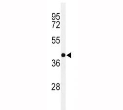 Anti-PAX-6