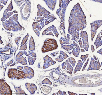 Anti-NPTX2 / Neuronal pentraxin 2