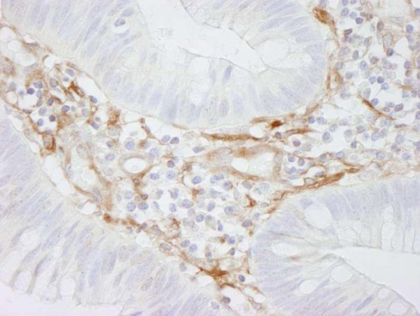 Anti-Filamin A (IHC)