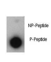 Anti-Phosphorylated-p21 (pT57)