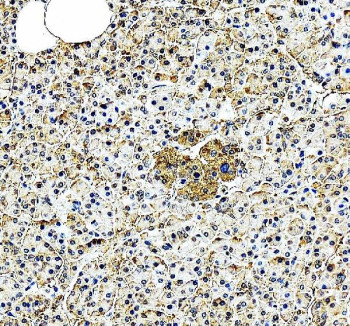 Anti-EIF2A / Eukaryotic translation initiation factor 2A
