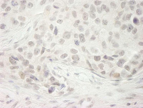 Anti-DHX33 (IHC)
