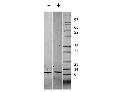 Gro Alpha (CXCL1)