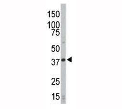 Anti-CDK4